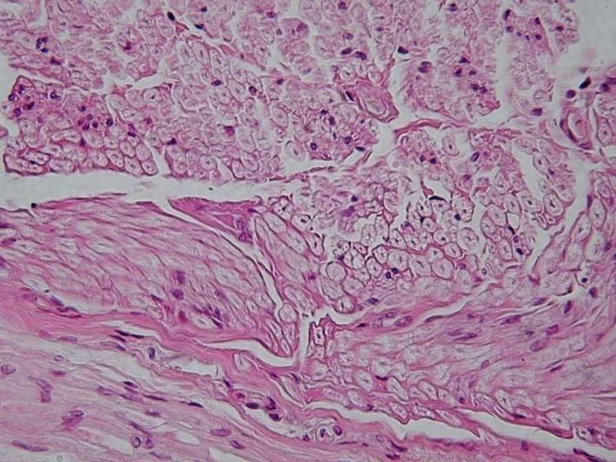 Tejido nervioso, imagen de microscopío óptico