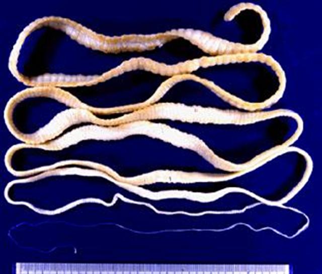 Endoparasitos - Tenia