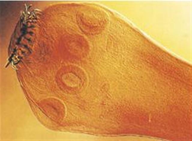 Endoparásitos - Tenia